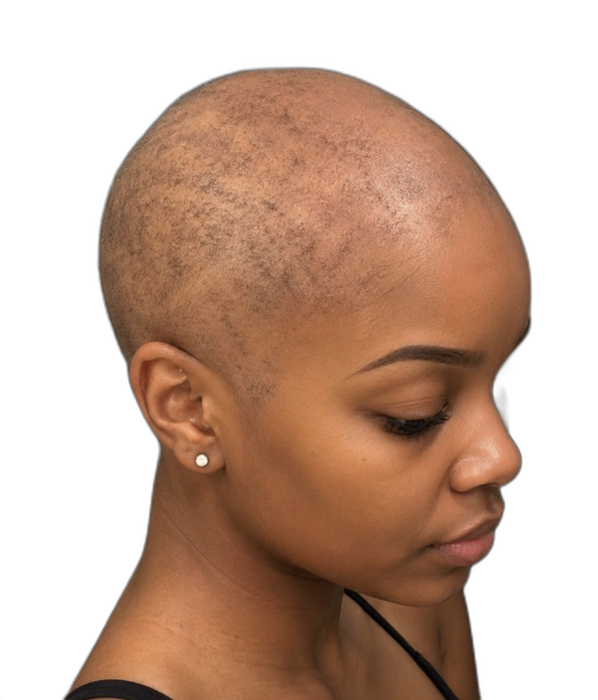 A confident Black woman at the start of her hair growth journey